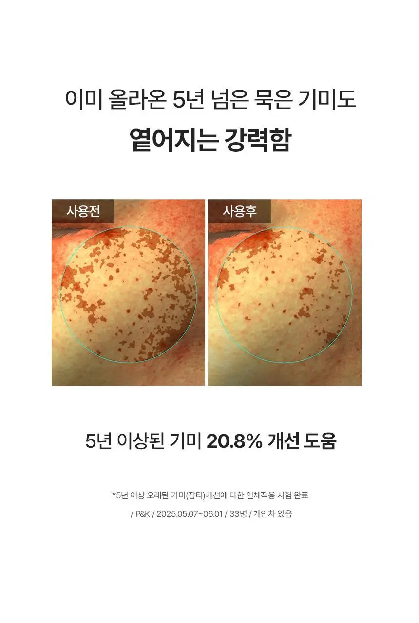 [1매/쫀광탄력] 아로셀 하이드로겔 마스크 3종 택1 (콜라겐/모공케어/기미토닝) 상세페이지 98